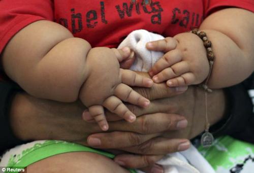 Ожиревшего 8-месячного малыша изъяли у родителей