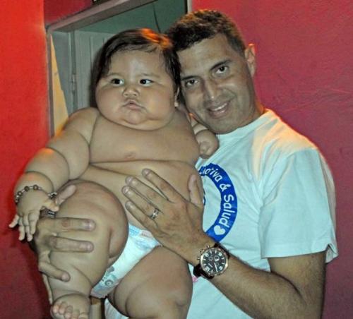 Ожиревшего 8-месячного малыша изъяли у родителей