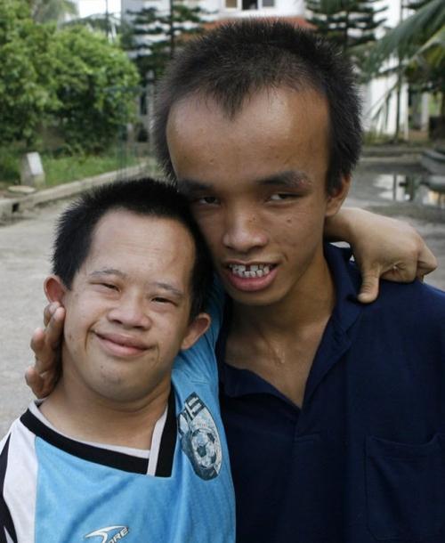 Страшные последствия химоружия во Вьетнаме