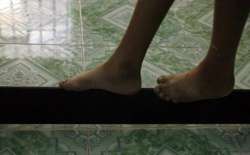 Страшные последствия химоружия во Вьетнаме