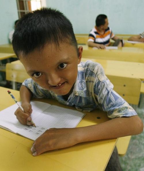 Страшные последствия химоружия во Вьетнаме