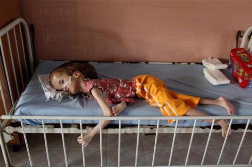 Страшные последствия химоружия во Вьетнаме