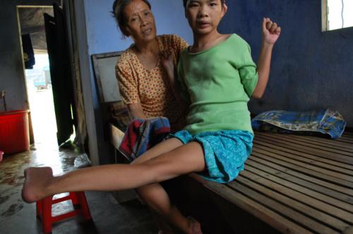 Страшные последствия химоружия во Вьетнаме