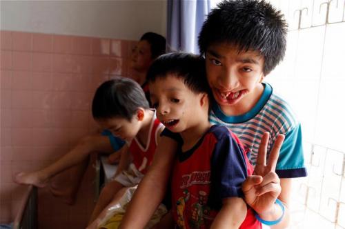 Страшные последствия химоружия во Вьетнаме