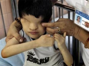 Страшные последствия химоружия во Вьетнаме