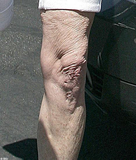 Снимки, которые звезды не хотели бы видеть в прессе-2