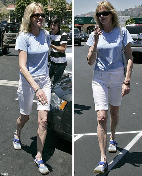 Снимки, которые звезды не хотели бы видеть в прессе-2