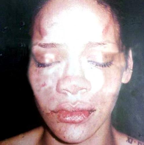 ТОП-10 звезд, ставших жертвами мужей-тиранов