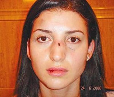 ТОП-10 звезд, ставших жертвами мужей-тиранов