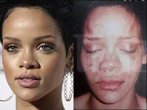 ТОП-10 звезд, ставших жертвами мужей-тиранов