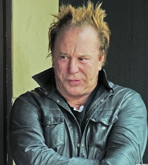 Красота — страшная сила: звезды, изуродованные пластикой