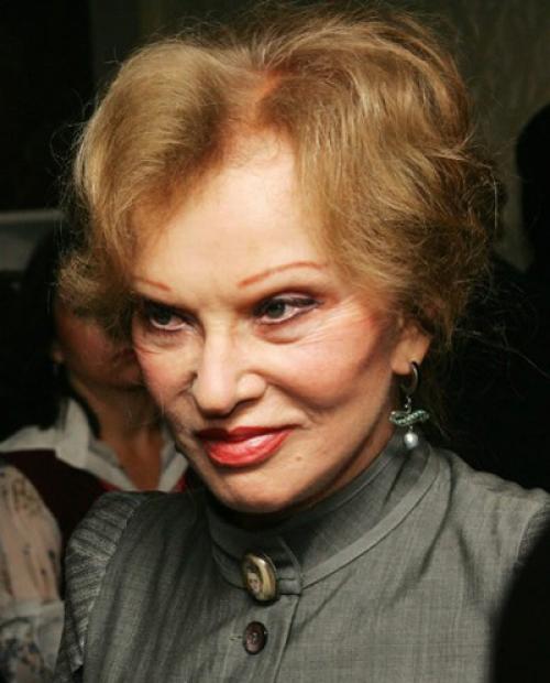 Красота — страшная сила: звезды, изуродованные пластикой