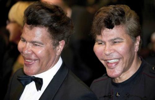 Красота — страшная сила: звезды, изуродованные пластикой