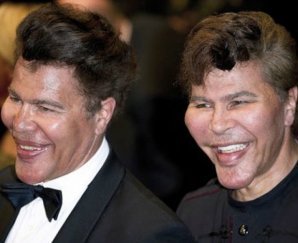 Красота — страшная сила: звезды, изуродованные пластикой