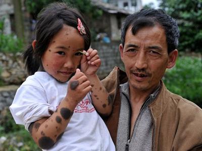 В Китае родители отказались от ребенка-оборотня