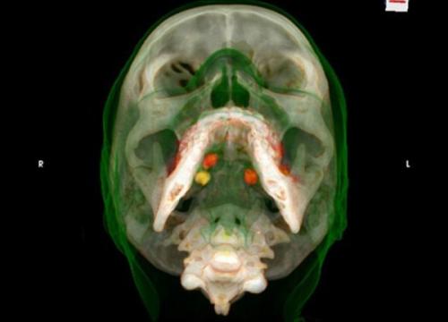 Как перевозят наркотики внутри человека