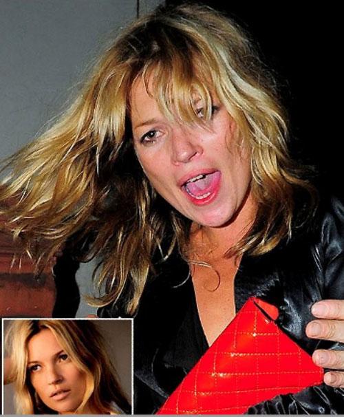 Пятна на лице и репутации: неряшливые знаменитости