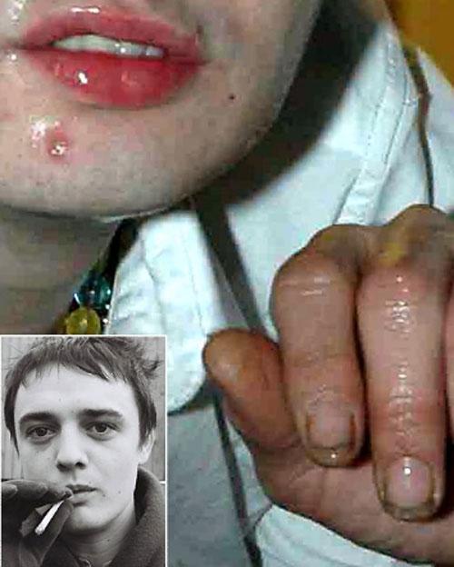 Пятна на лице и репутации: неряшливые знаменитости