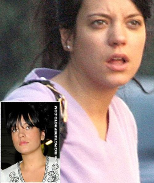 Пятна на лице и репутации: неряшливые знаменитости