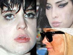 Пятна на лице и репутации: неряшливые знаменитости