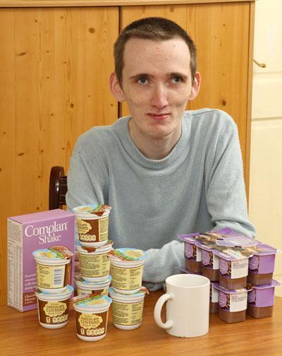 23-летний британец-анорексик боится твердой пищи