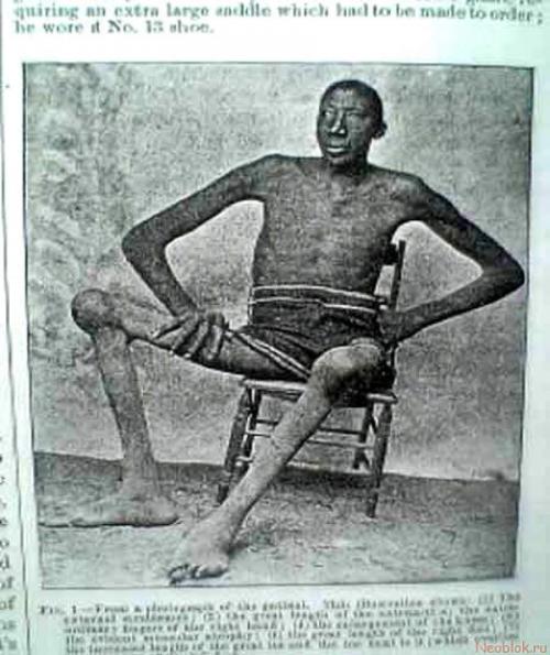 Самые высокие и самые низкие люди мира