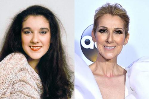 Самые нелепые прозвища знаменитостей