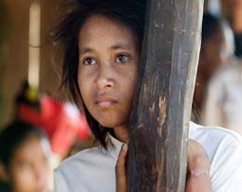 Камбоджийская женщина-маугли попала в больницу