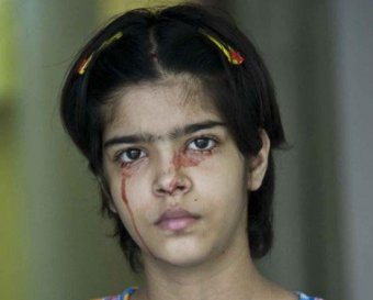 Индийская девочка плачет кровавыми слезами