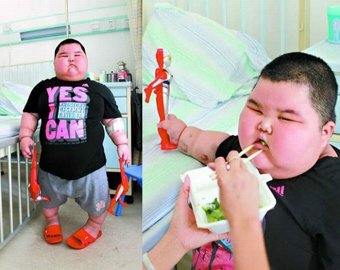Самый толстый ребенок в Китае в 3 года весит 64 кг