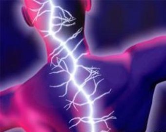 Американец выжил после удара током мощностью 14 500 вольт