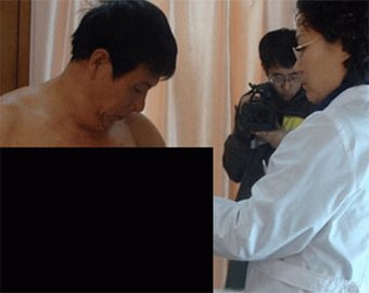 В Китае найдена самая большая мужская … грудь!