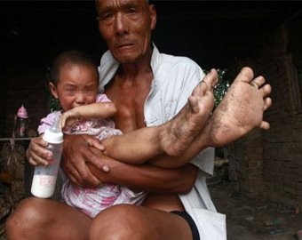 У китайской девочки ноги растут быстрее всего тела
