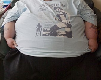 Подросток похудел на 56 килограммов ради сходства с кумиром