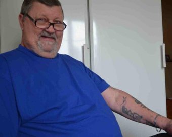 Спустя 40 лет мужчина обнаружил под кожей иглу от тату-машинки