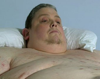 В Сеть попали рентгеновские снимки тела 400-килограммового мужчины