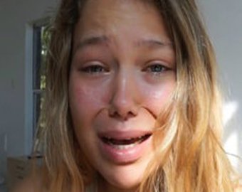 Звезда Instagram призналась, что слава сделала ее несчастной
