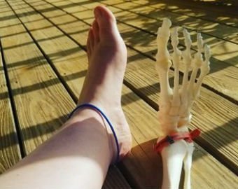 Девушка посвятила Instagram своей ампутированной ноге
