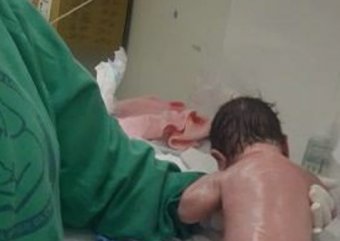 В Индии новорожденный младенец пошел сразу после рождения (ВИДЕО)