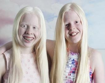Подружки-альбиносы набирают популярность в интернете