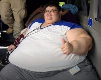 Самый толстый мужчина в мире лег под нож
