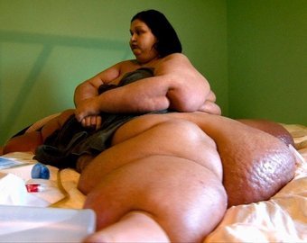 Самая толстая планеты женщина похудела на 403 килограмма