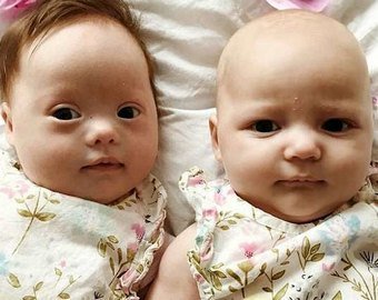 Англичанка родила близнецов, один из них появился на свет с синдромом Дауна