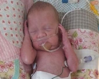 Женщина приехала в больницу с болью в животе, а через час родила ребенка