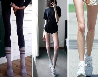 Аномально худые ноги модели шокировали интернет-пользователей