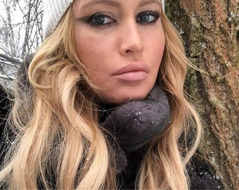 Дана Борисова обнародовала видео, как ей делают подтяжку лица