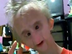 12 летний мальчик выглядит как старик