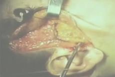 Пластическая операция он-лайн!