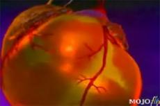 Ученые продемонстрировали с помощью 3D — анимации природу инфаркта