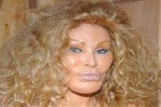 Жертва пластической хирургии №1 — Jocelyn Wildenstein